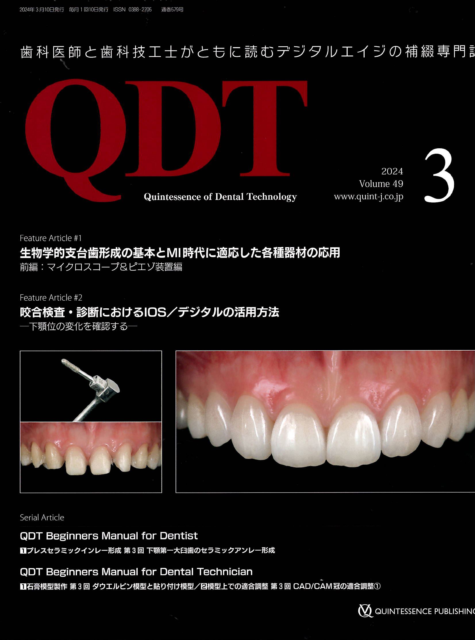 当院が提携している歯科技工士（長谷川氏）が当院で実施した治療症例が掲載されました。